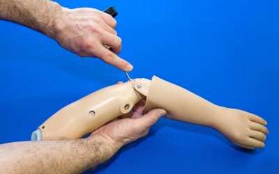 Changing Lives in India: Artificial Hands For the Handicapped Restore Independence